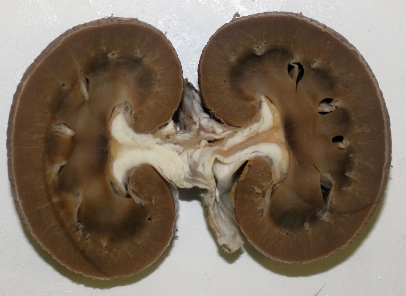 Zinside Beauty lab — plastination process at Tuskegee University