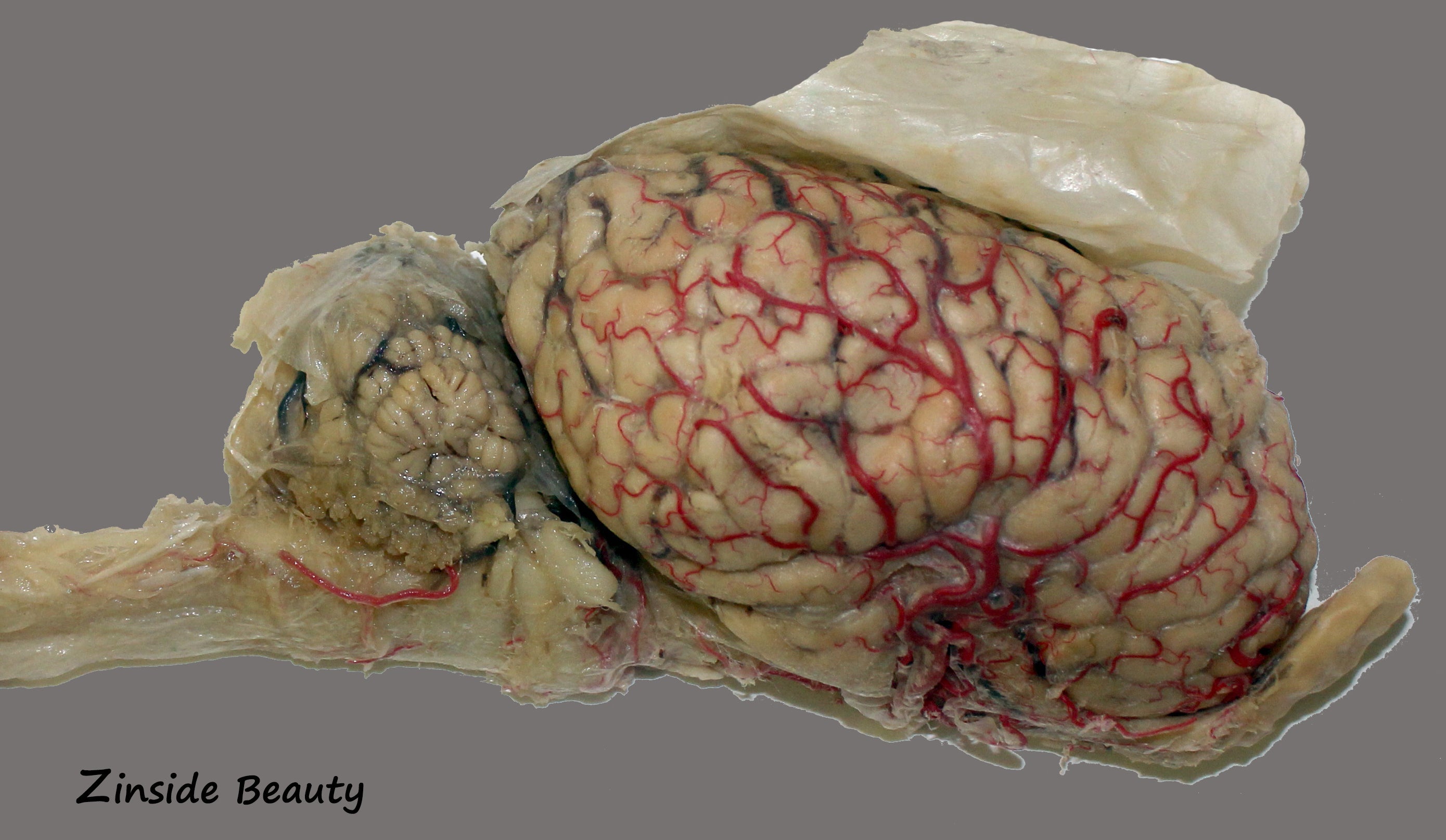 Custom Plastination Orders