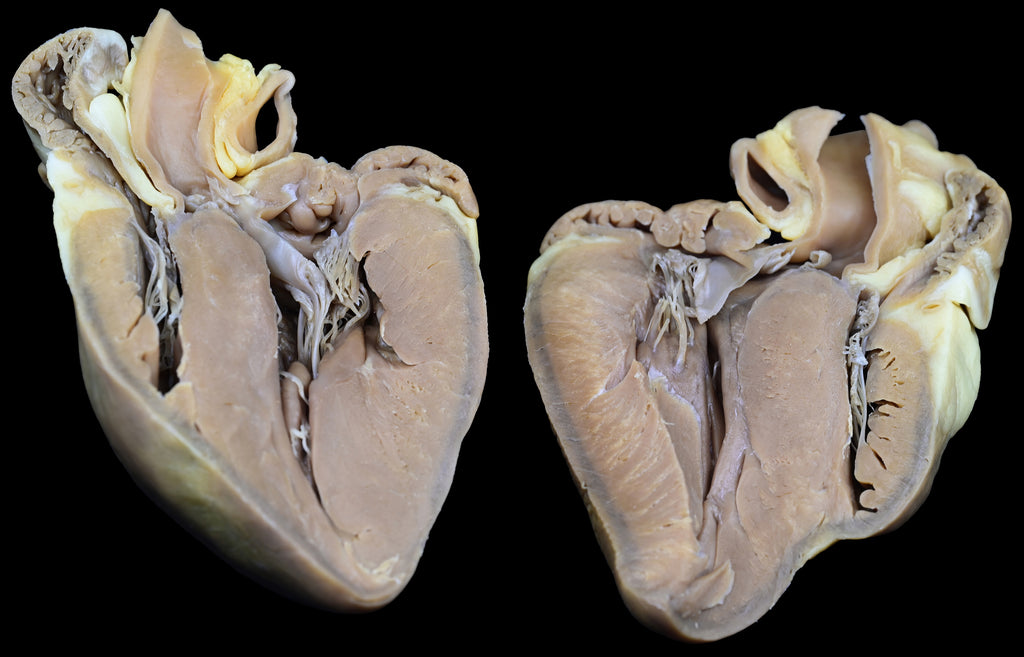 Plastinated Heart of a Pig