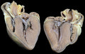 Plastinated Heart of a Pig