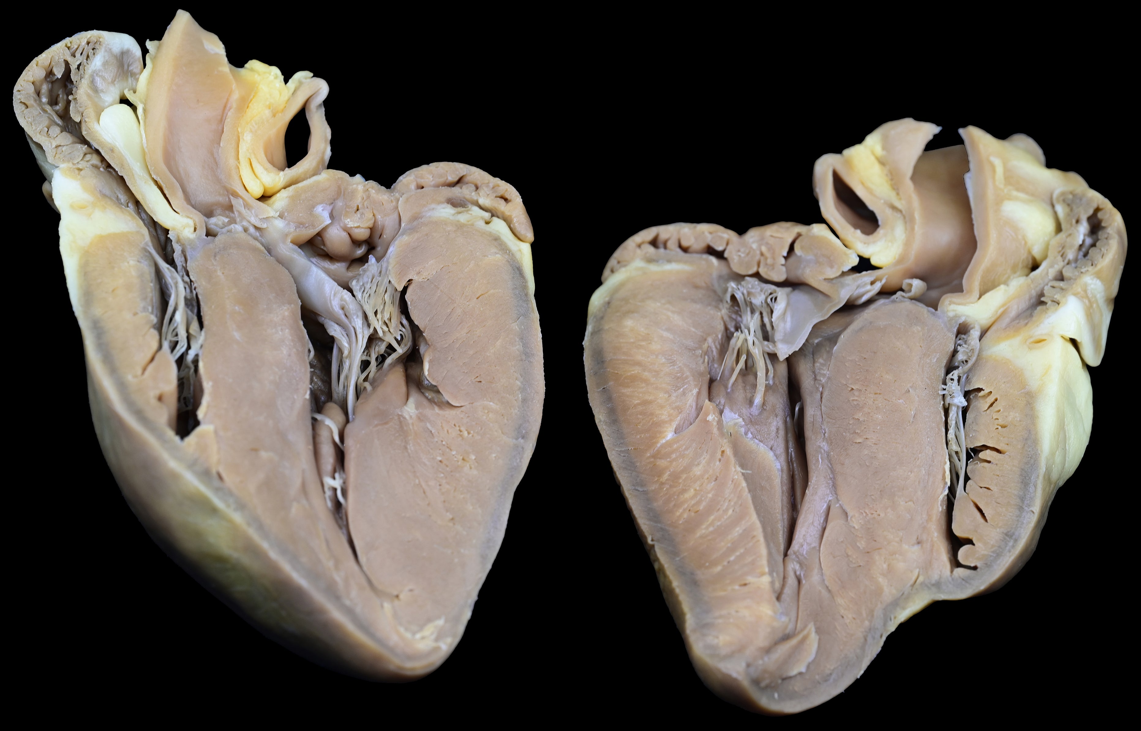 Plastinated Heart of a Pig