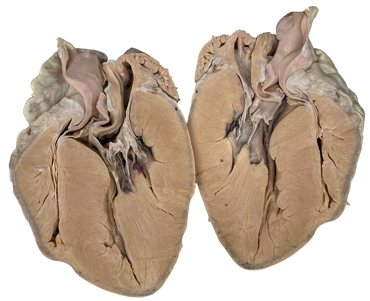 Plastinated Heart of a Pig